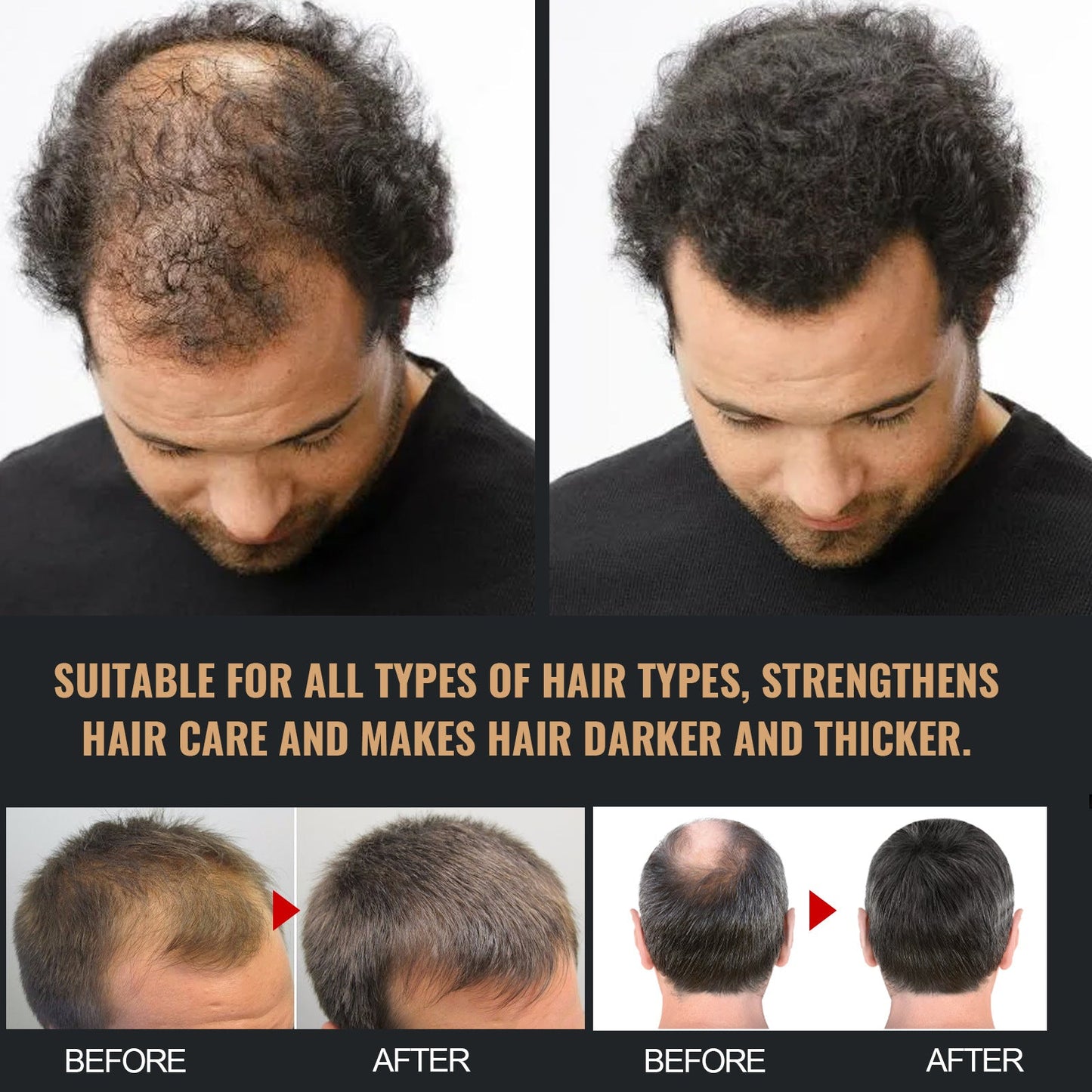 Dense Hair Shampoo