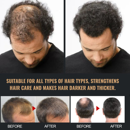 Dense Hair Shampoo