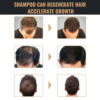 Dense Hair Shampoo