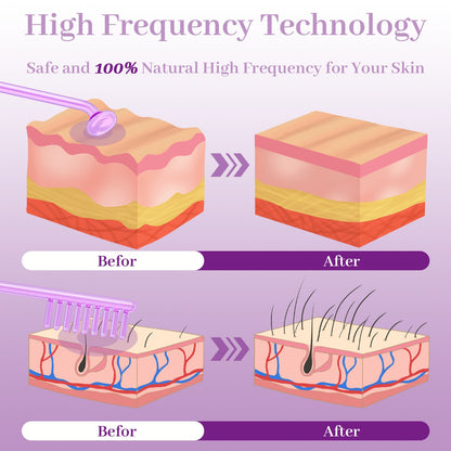 High Wave Electrotherapy Rod High Frequency Beauty Instrument Eutic Appliance