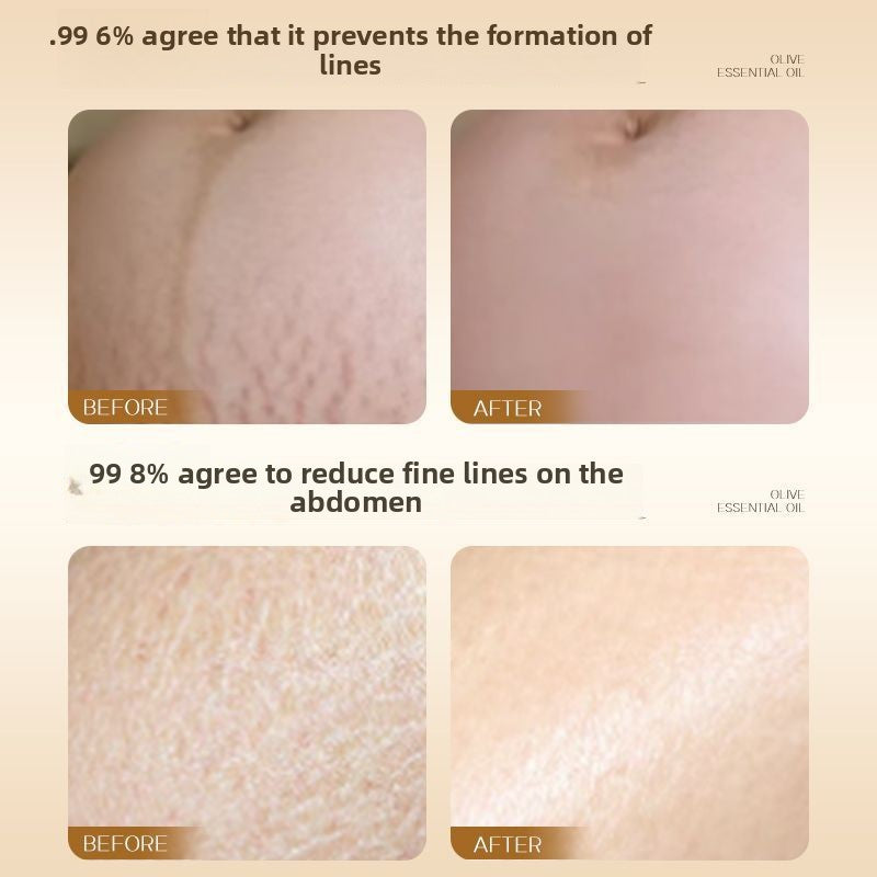 Olive essential abdominal lines prevention oil