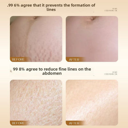 Olive essential abdominal lines prevention oil