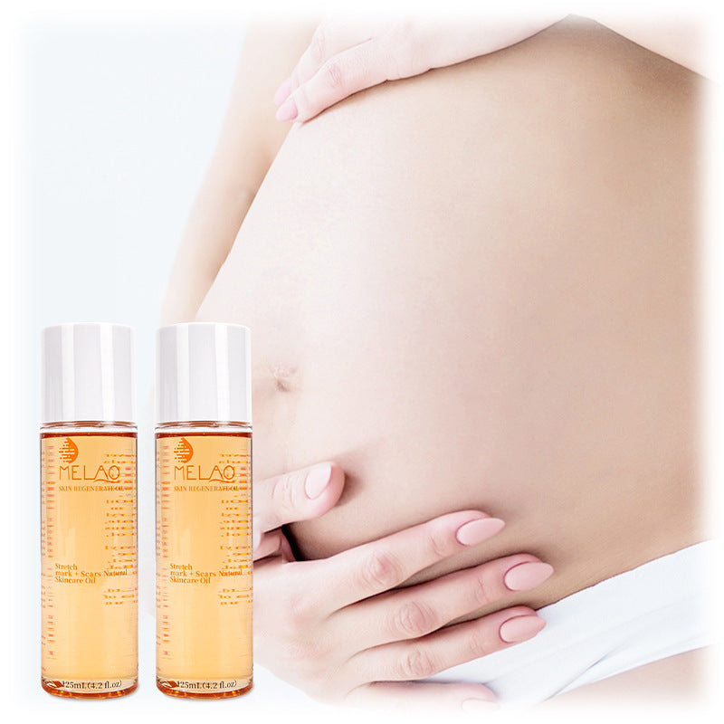 Stretch Marks Repair Oil