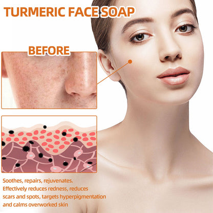 Turmeric Spot Cleansing Soap
