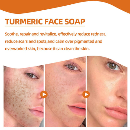 Turmeric Spot Cleansing Soap