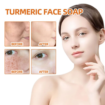 Turmeric Spot Cleansing Soap